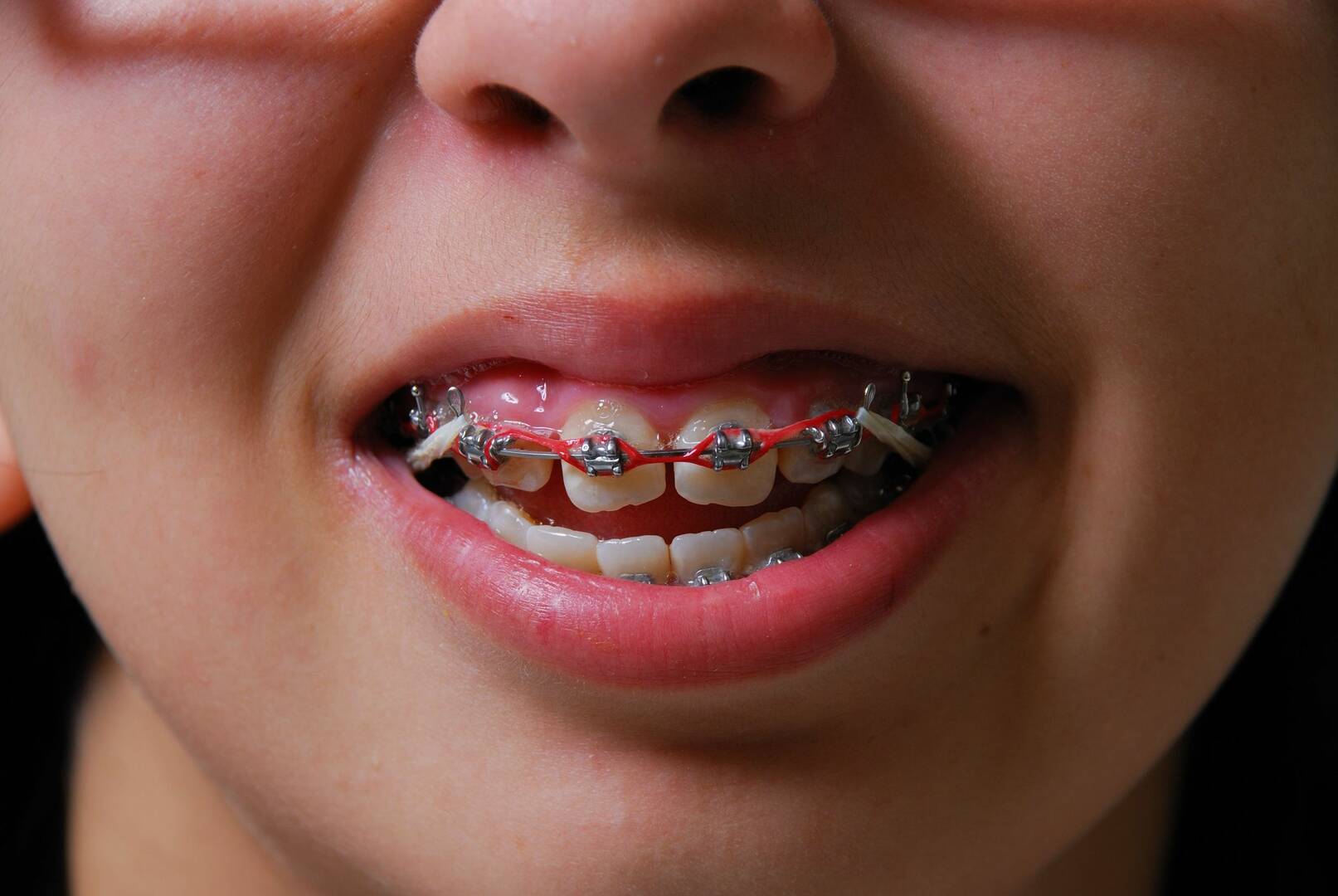 Runcorn Dental